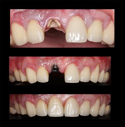 FIVE TABLE STYLES I’M LOVING NOW